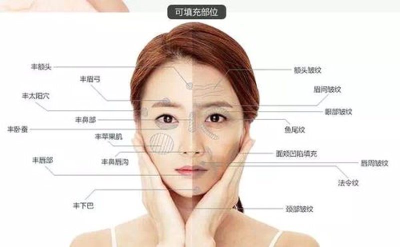 瘦身魔力:吸脂瘦身医院的发展与趋势